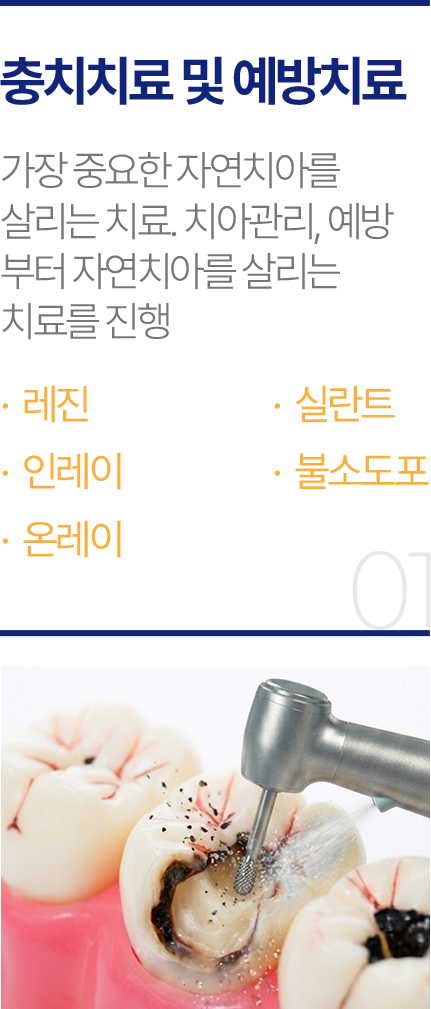 충치치료 및 예방치료