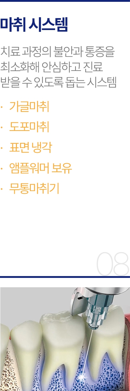 마취 시스템