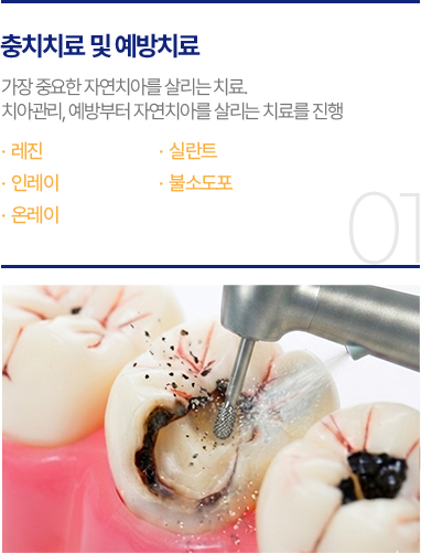 충치치료 및 예방치료